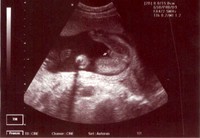 Baby Parks